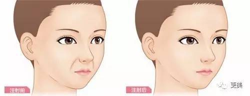 小女孩7岁割双眼皮！讲真整容的最佳年龄是多少？