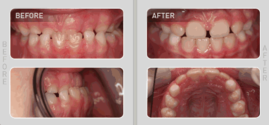 六一儿童节关爱儿童口腔健康尽享欢乐童趣