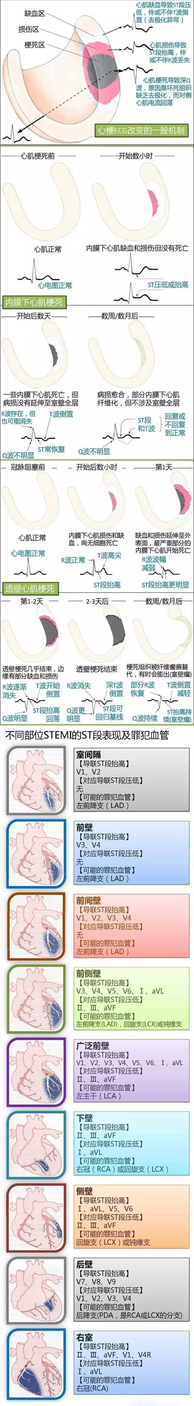 心血管疾病|心血管疾病图文详解！太珍贵了！看完全明白！