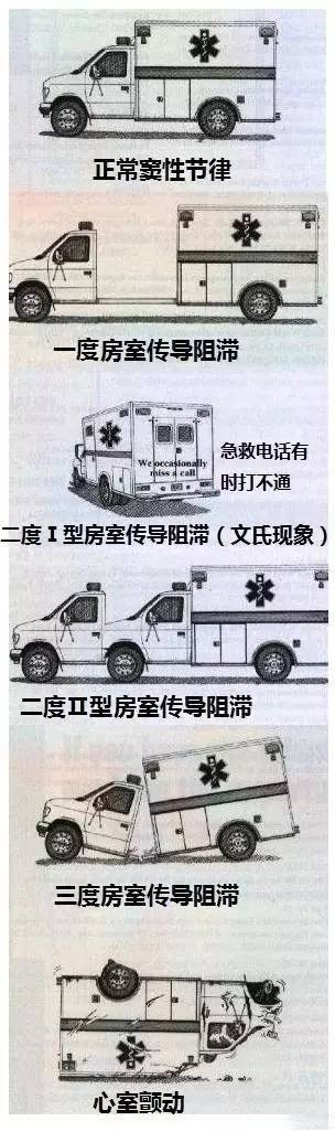 心血管疾病|心血管疾病图文详解！太珍贵了！看完全明白！