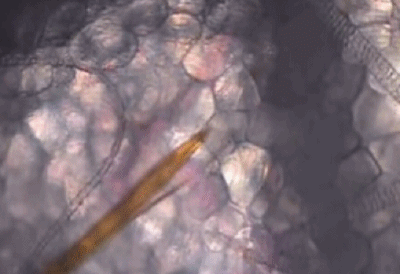 蚊子|全世界最“致命”的动物是什么？每一次叮咬可能传播4种疾病