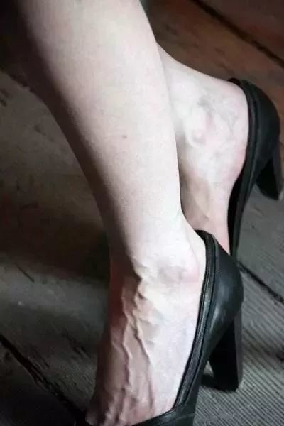 手上青筋越多,说明身体越