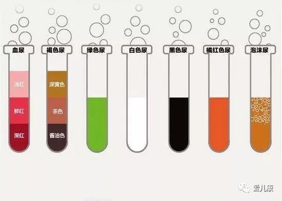 宝宝的7种尿液颜色 有2种最危险 腾讯网