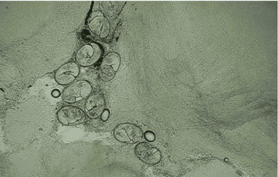 寄生虫|说出来你可能不信，吃寄生虫还真的可以治病