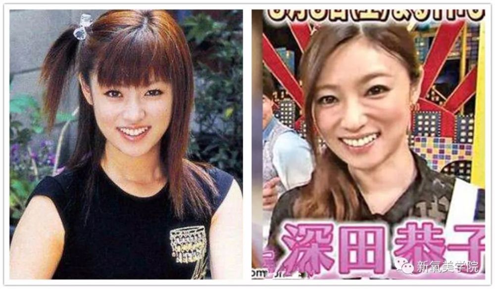 她是日本最甜女星 16岁美炸天 30岁整残 35岁美回巅峰 腾讯网