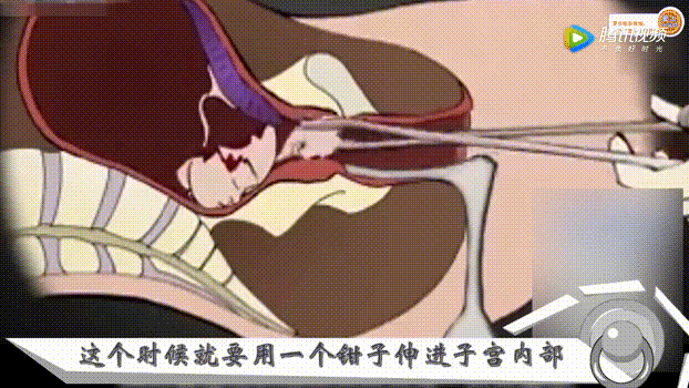 622_350gif 动态图 动图