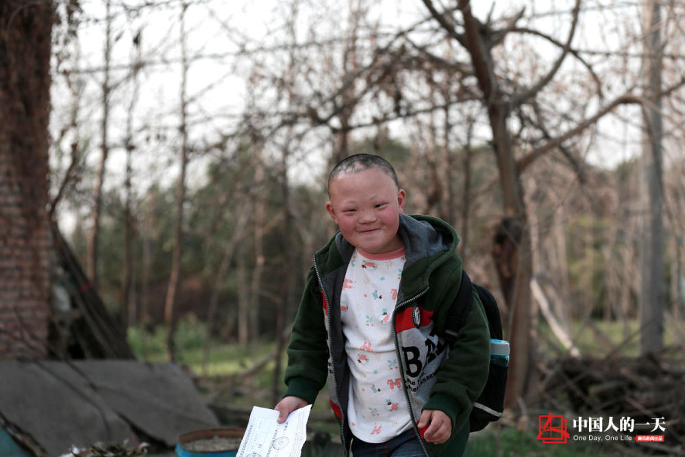 唐氏患儿里的优等生 阿姨别怕,我不是傻子