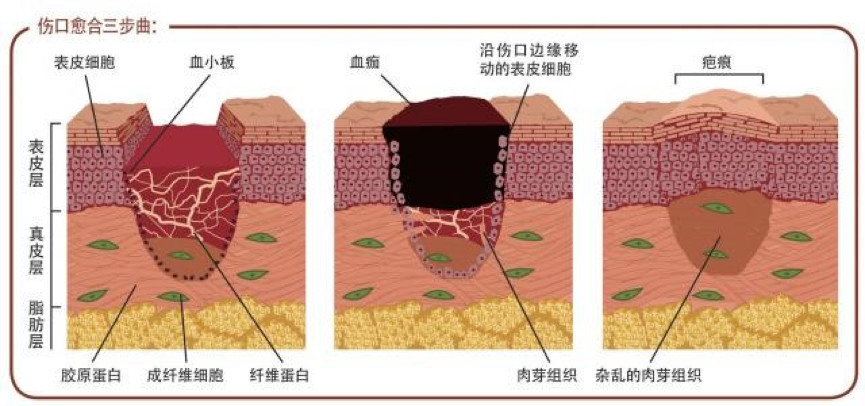 流脓 发炎 过敏 为啥耳洞打了很久 就是好不了 腾讯网