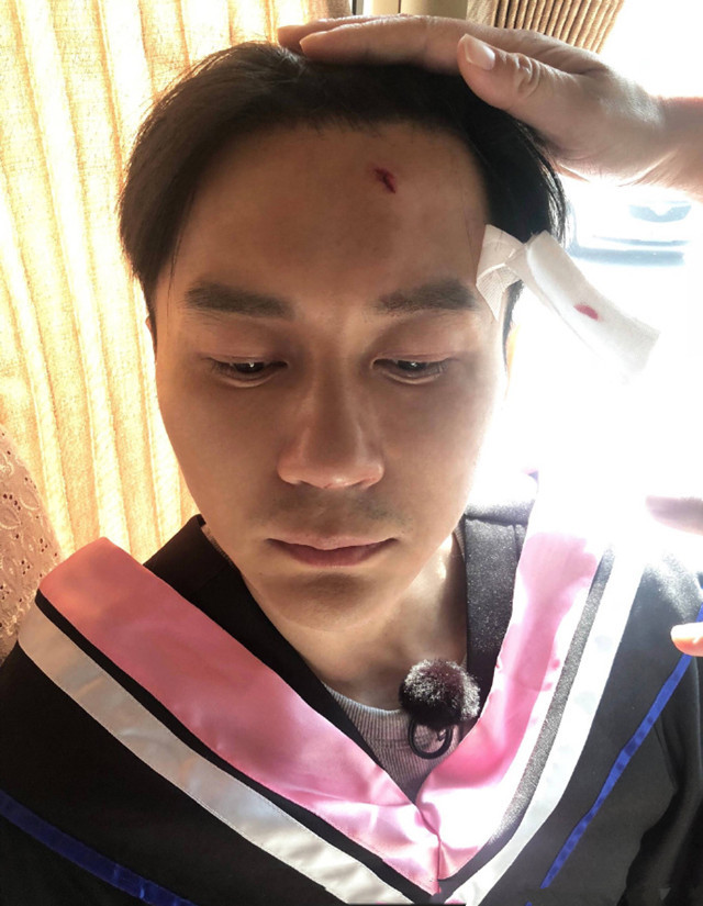 李晨跑男受伤照曝光,此前多次骨折、脱臼、缝