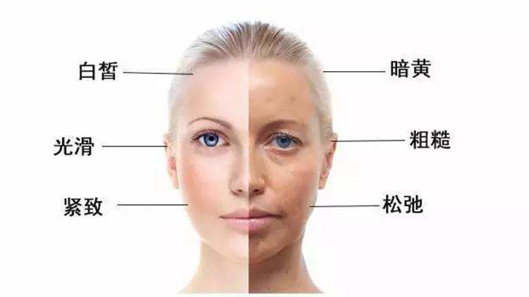 吃糖会引起皮肤衰老 糖化 对人体有什么危害 腾讯网