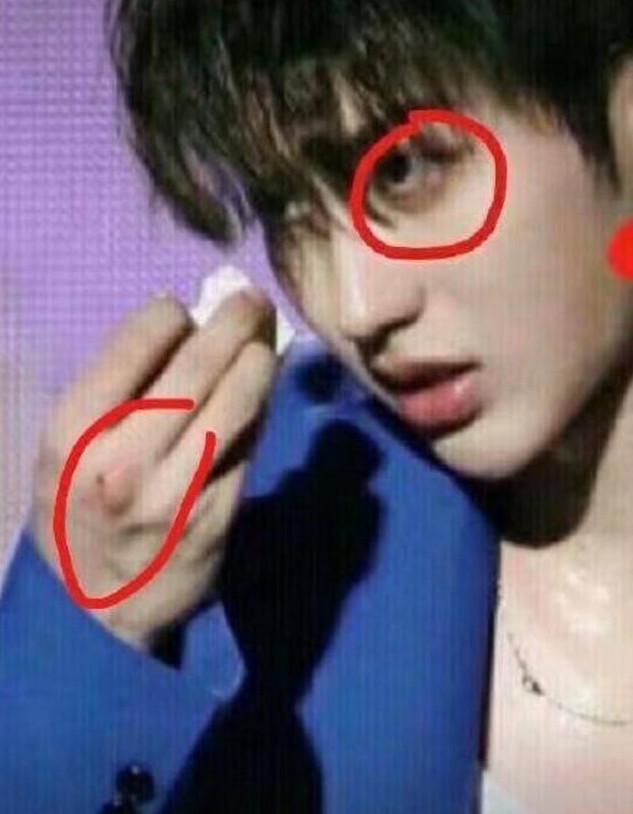 蔡徐坤被激光笔照