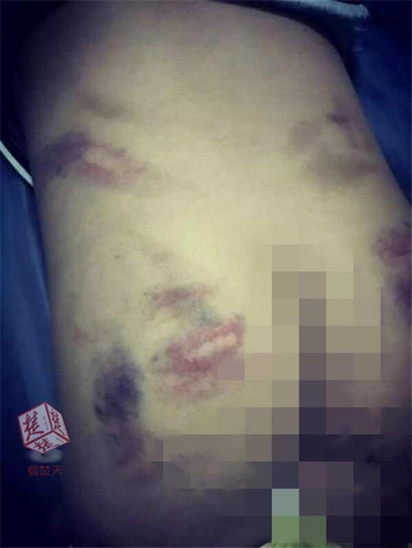 小学生作文不及格遭老师打屁股被家长投诉