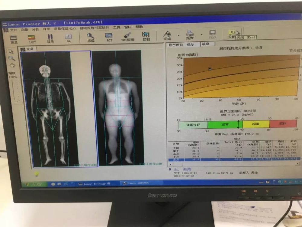 体脂秤到底是不是智商税 测完8款告诉你答案 腾讯网
