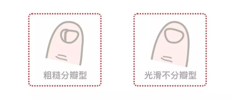 你从哪里来?看看脚趾甲是否分瓣