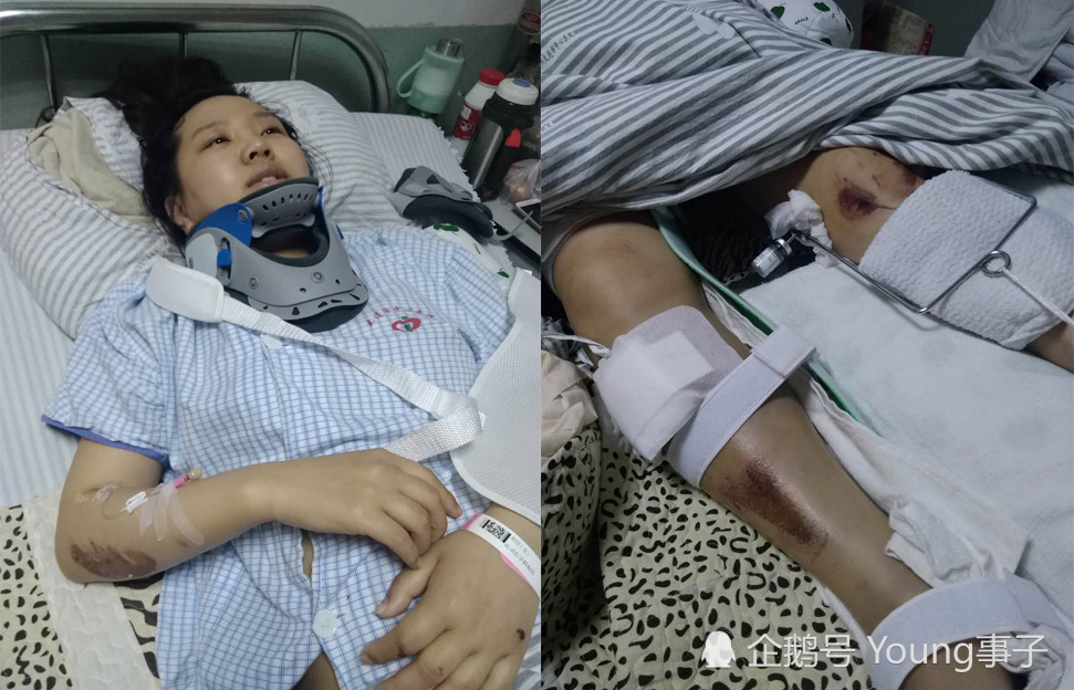 辽宁女孩遇车祸全身粉碎性骨折高额手术费难倒一家人