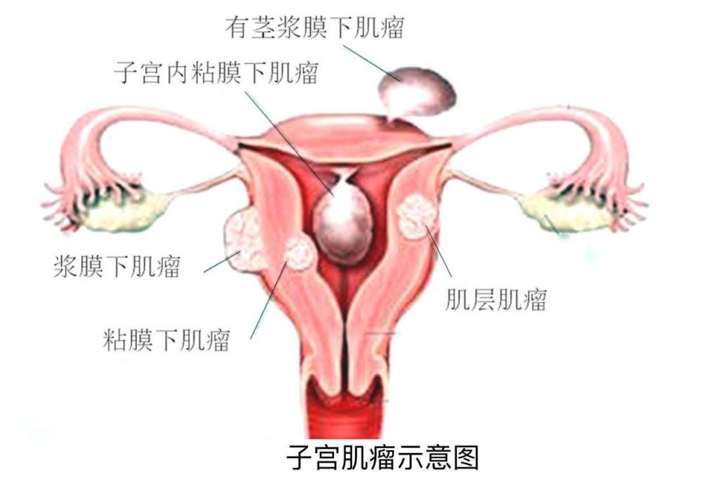 å­å®«èç¤