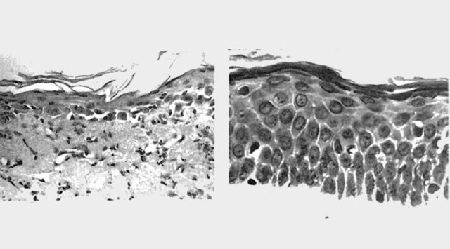 为什么你擦那么多美白精华都没用?皮肤还是那