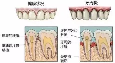 人的牙齿名称结构图