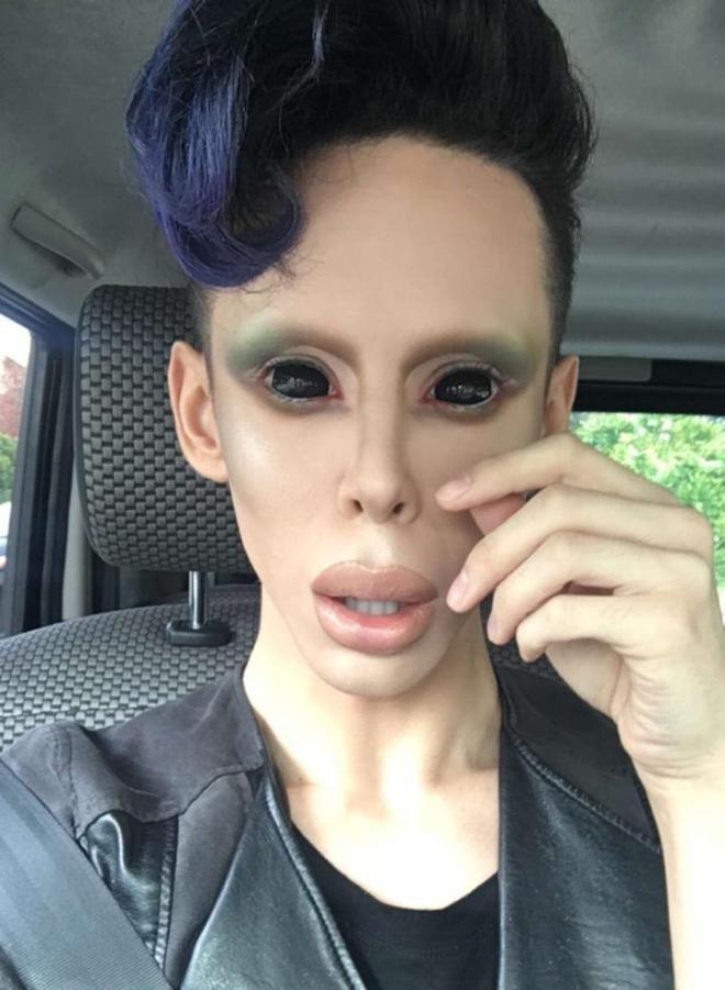 盘点全球5大整容狂人,最后一名号称世界最帅的人