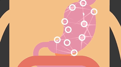 cell原来饱腹感信息是伸展的肠道告诉我们的