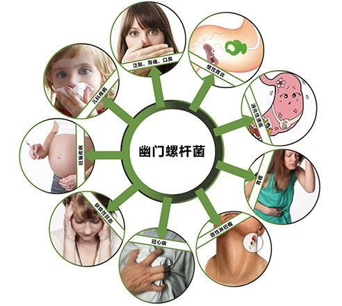 预防幽门螺杆菌 从这5点做起 让你远离胃病困扰
