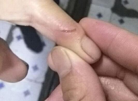 梦的细语，解析梦见手被老鼠爪子划过的深层含义
