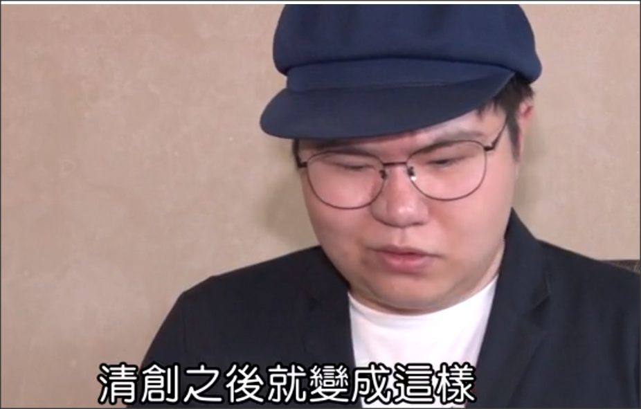 网红贪小便宜做免费隆鼻手术，结果导致毁容以及右眼失明
