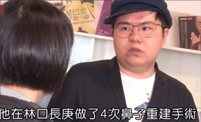 网红贪小便宜做免费隆鼻手术，结果导致毁容以及右眼失明