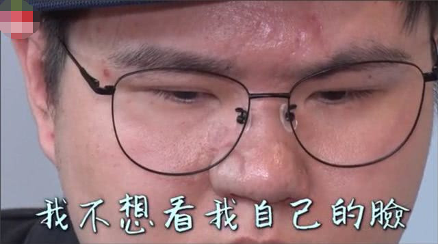 网红贪小便宜做免费隆鼻手术，结果导致毁容以及右眼失明