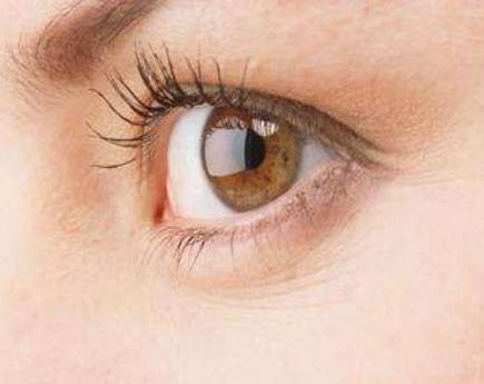 眼下细纹是怎么形成的如何才能去除眼下细纹 腾讯网