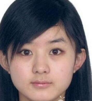 赵丽颖整容前简直吓死人,以前为钱出卖身体还