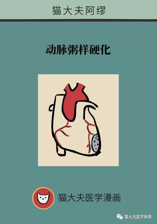 动脉硬化究竟是怎么回事?能逆转吗?