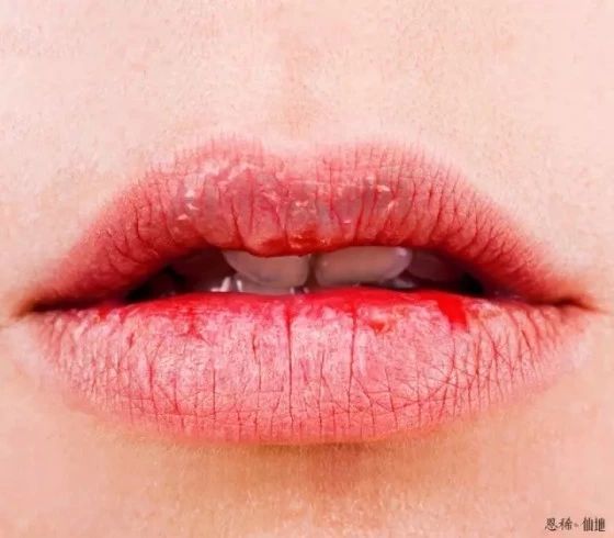 五官完美如张嘉倪 颜值都被这个暗沉部位拉到低谷 腾讯网