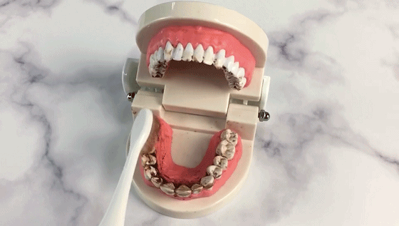 种植牙为什么能让老年朋友焕发第二春?因为解决了吃饭问题