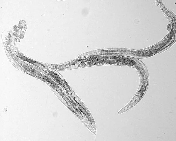 拿下诺奖三杀的线虫侧躺着走路千里挑一才有真男人