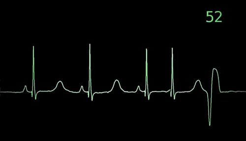 明明是牙疼肩疼胃疼为什么医生建议做心电图