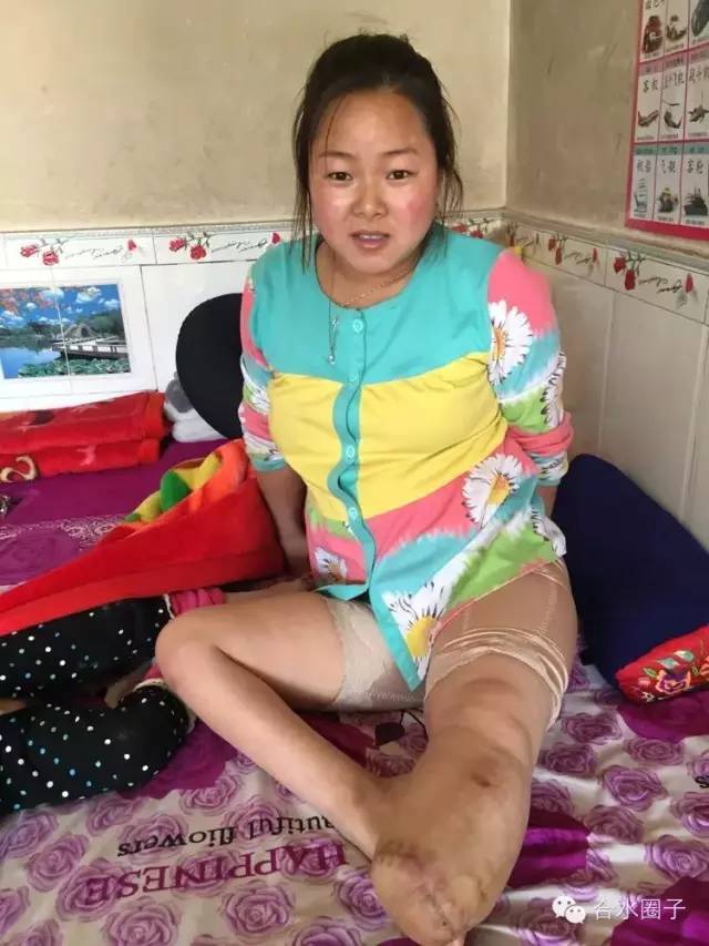 庆阳残疾人刘芳芳的这场婚礼,感动全城!