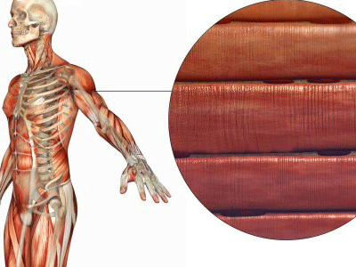 超负荷运动易发生横纹肌溶解 ,开学军训期间是该病高发期