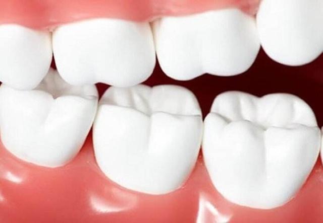 长期洗牙对牙齿健康是好是坏?终于有了答案,到