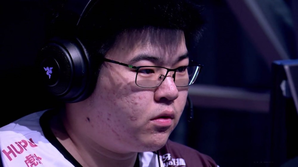 天命杯:韦神得罪摄像师?满脸痘痘,网友:这个猪头肉没法吃