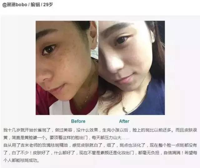 睡前用一物擦脸,祛斑美白补水,轻轻松松年轻1