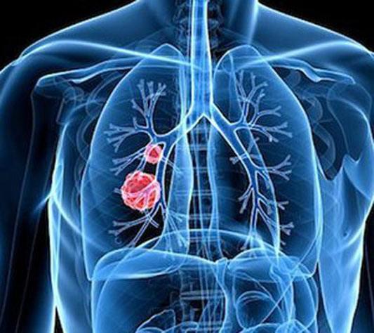 大家都知道吸烟有害健康,可薄荷烟就可以减少