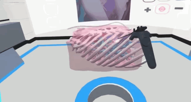 \