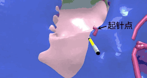 \