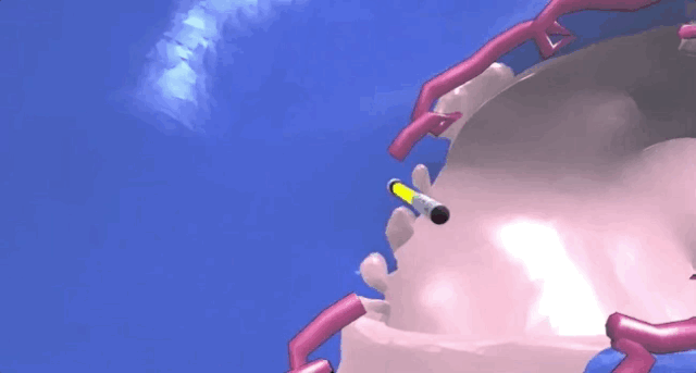 \