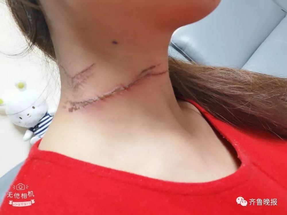 济南又有人被风筝线割颈还是怀孕8个月准妈妈这祸谁来消