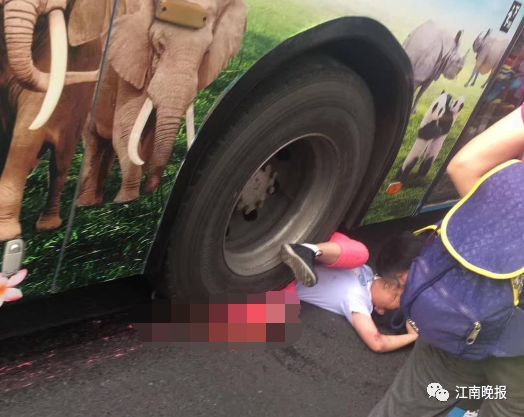心痛!学前东路上车祸,女孩一条腿几乎被碾碎