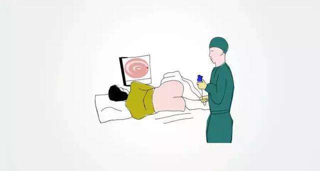 别再害怕肛门镜检查了