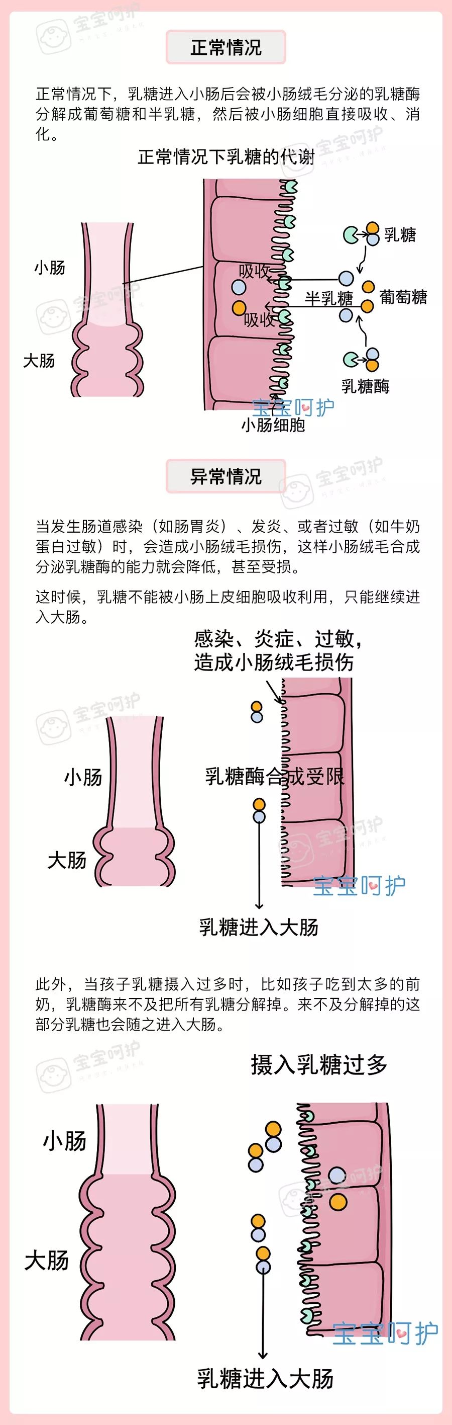 孩子腹泻老好不了,多半是这个病因搞得鬼!很多医生都会漏诊