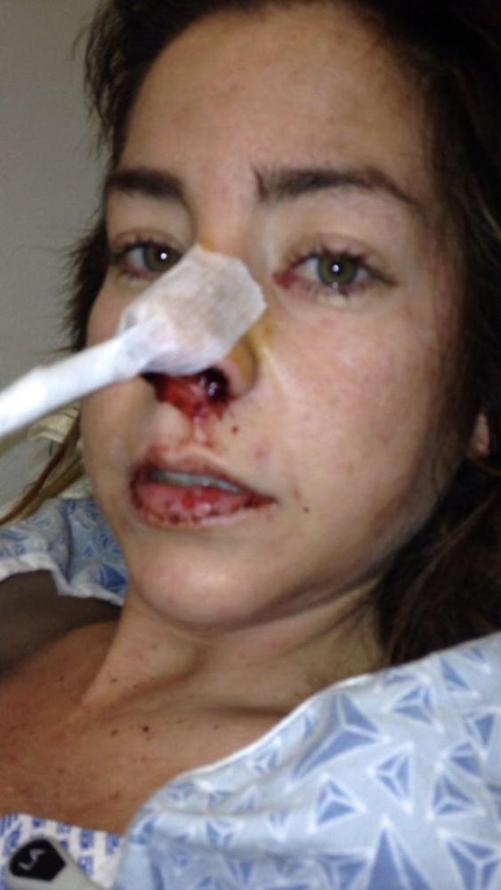 杰西卡·兰登,伏特加酒,花花公子,酒精,皮肤